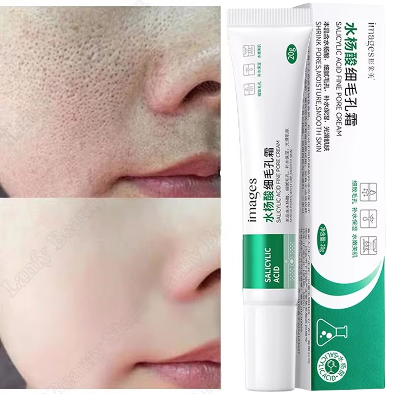 Salicylic Acid Blackhead Remover - كريم حمض الساليسيليك لتنظيف المسام وتقليصها