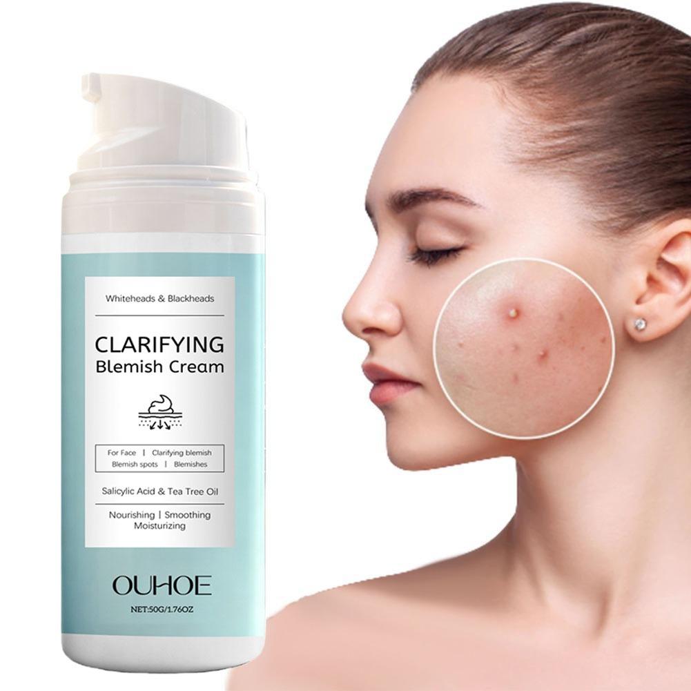 كريم حمض الساليسيليك لإزالة حب - مراجعة Salicylic Acid Blackhead Remover وسعره